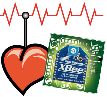 Wireless ECG