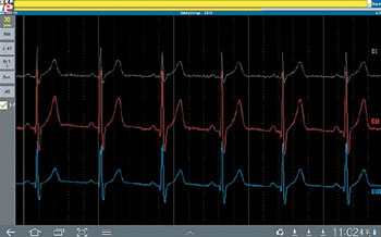 sin hilos, sin botones: Bluetooth y pantalla táctil